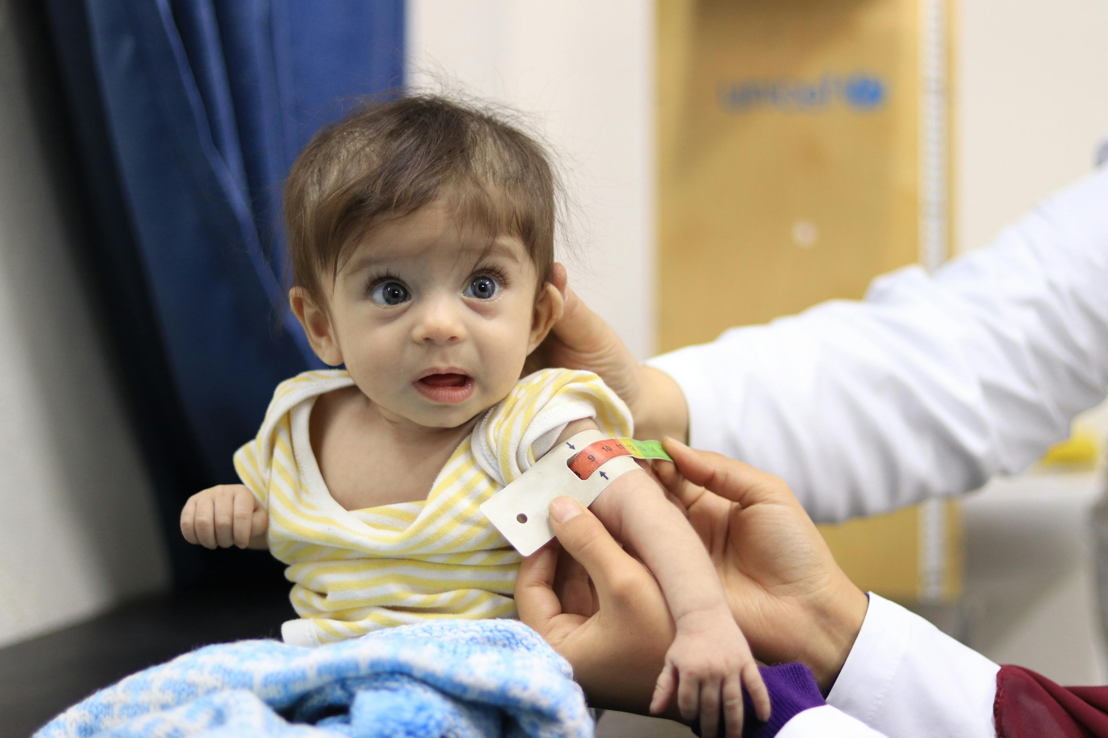 A baby is having her arm measured to check for malnutrtion