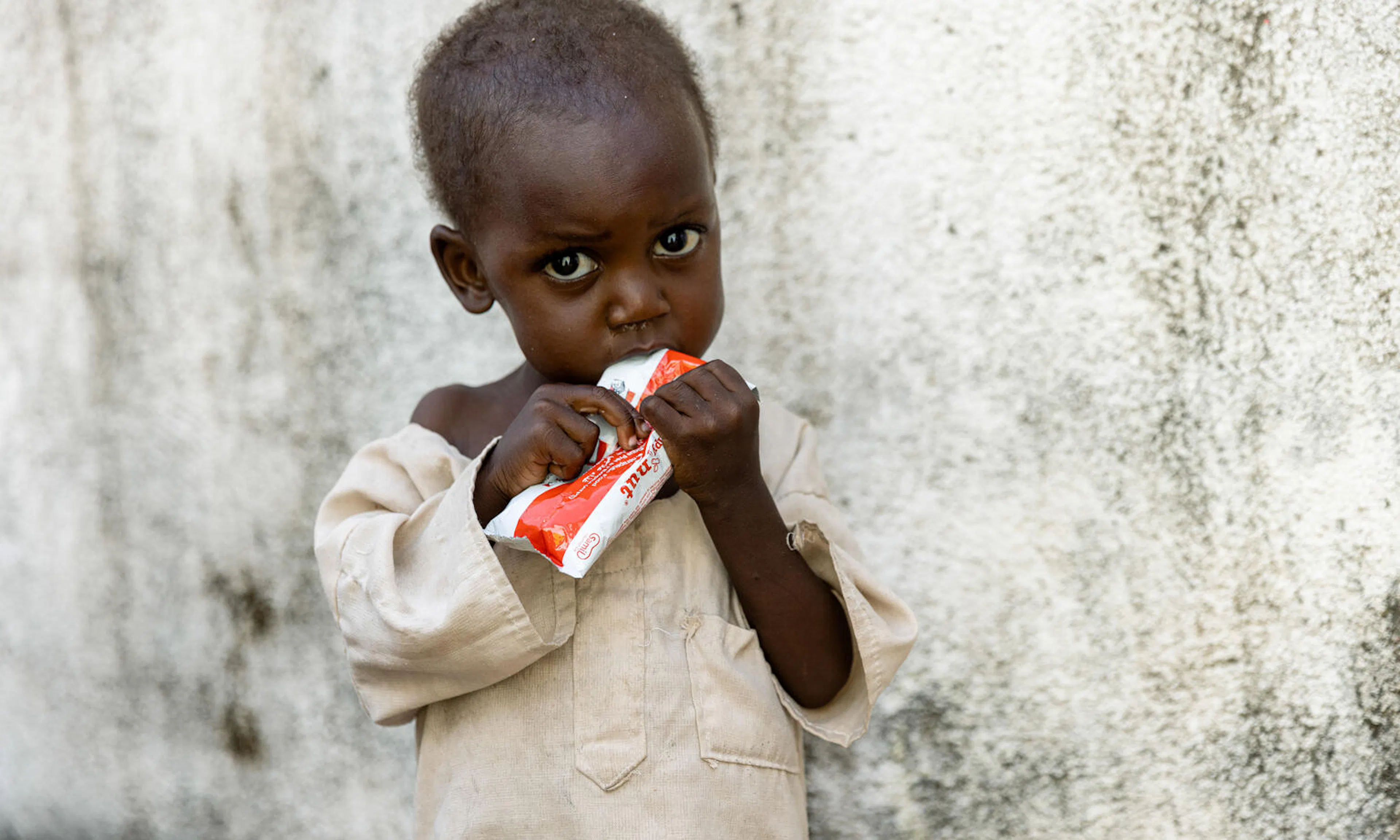 at Alnahda Health Centre in Nyala, South Darfur, Sudan, a child eats Ready-to-Use Therapeutic Food (RUTF) during a nutrition screening. 