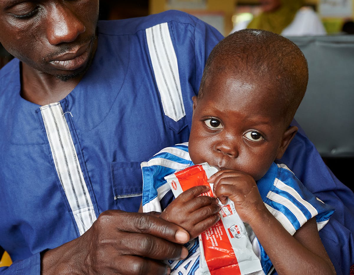 After a growth monitoring assessment through MUAC measurement, a man sits holding his child while the child eats peanut paste (plumpy nuts) at Tamale West Hospital in Tamale. Ghana.