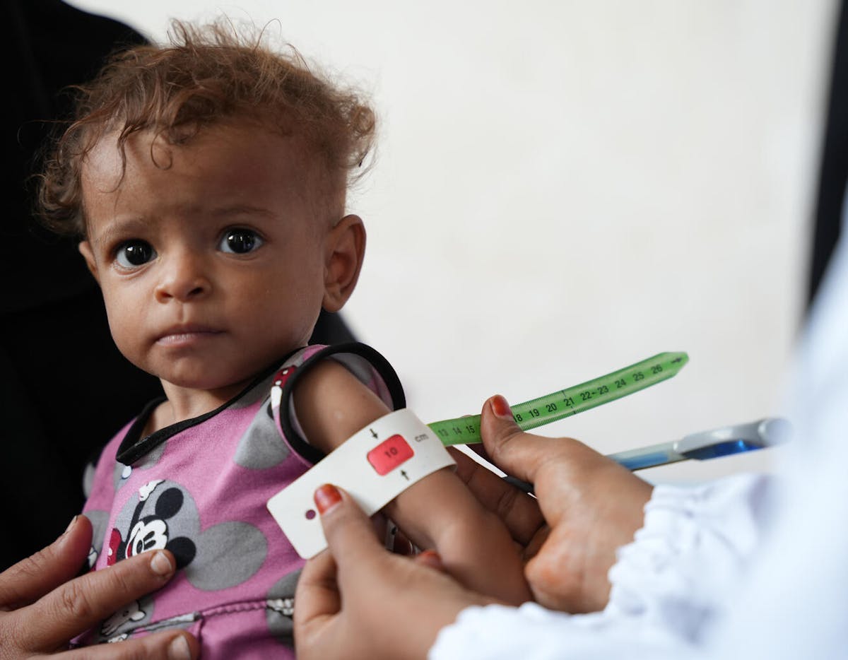 In Yemen, ongoing conflict has pushed millions of children into severe malnutrition. Children like Kiara are struggling to survive without the food they need.
