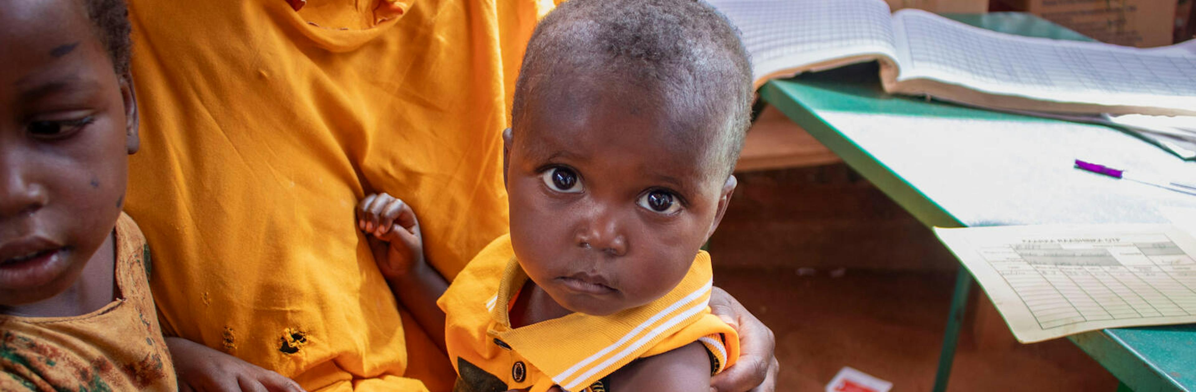 18-month-old Sabir is screened and treated for malnutrition at the Kahary IDP camp in Somalia.