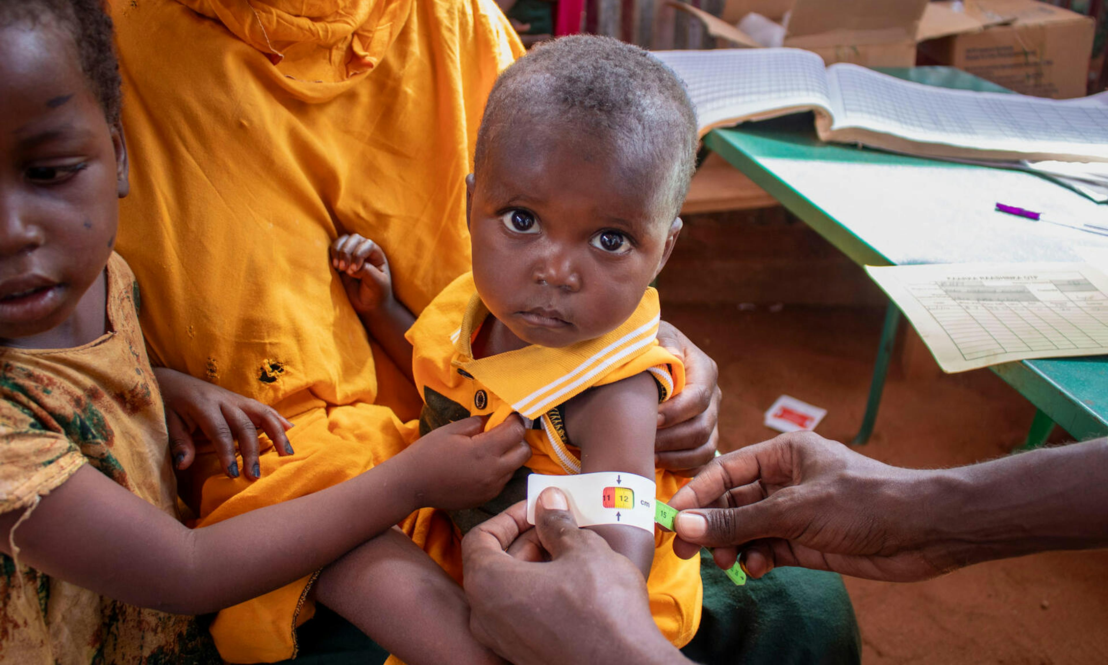 18-month-old Sabir is screened and treated for malnutrition at the Kahary IDP camp in Somalia.