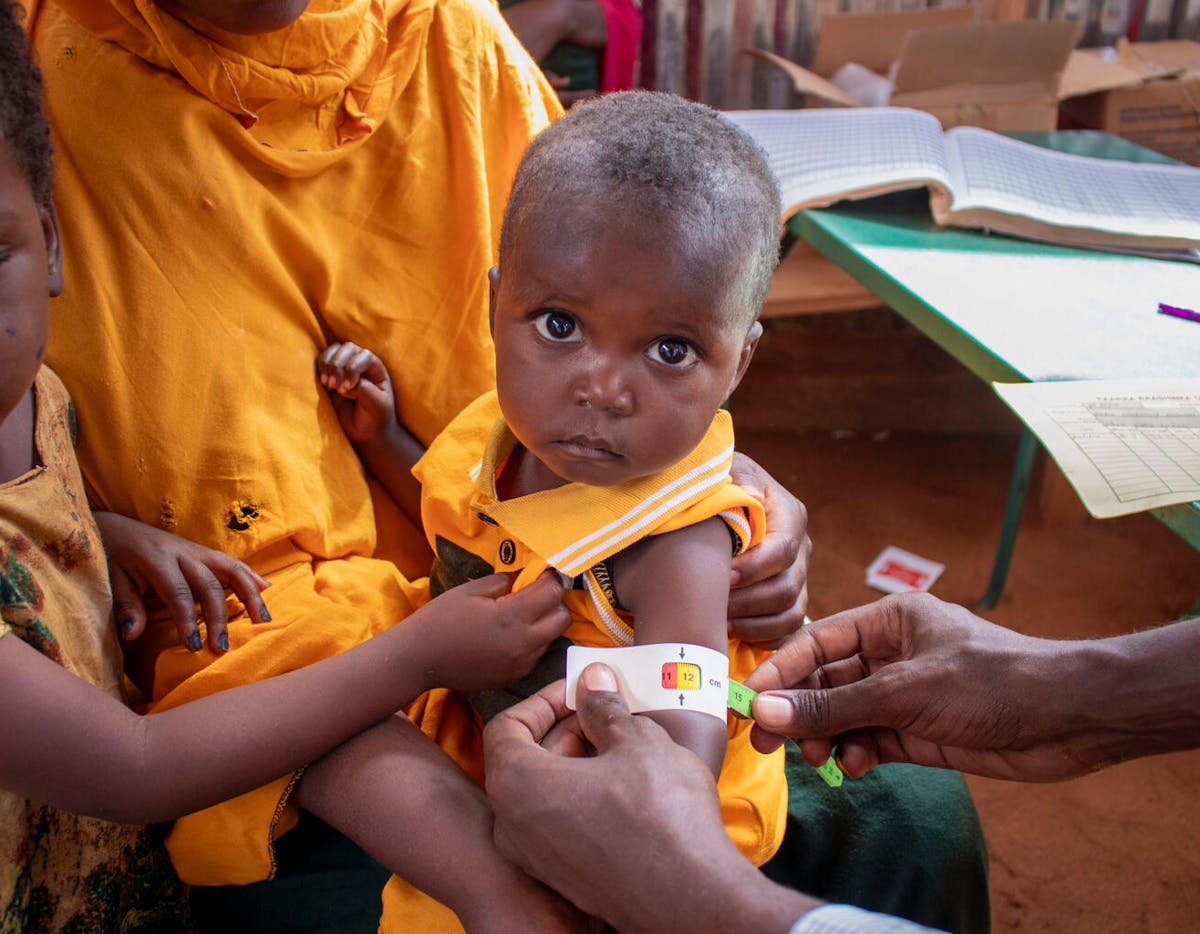 Sabir (18 months), Somalia