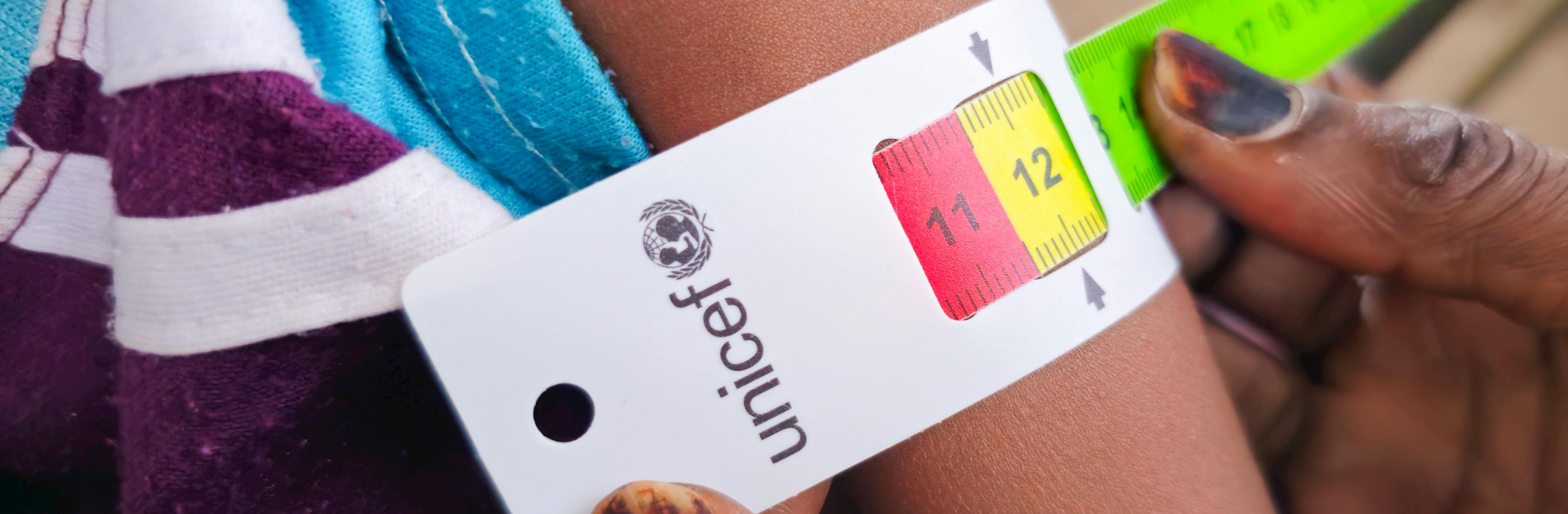 Health workers from a mobile clinic screen children and pregnant women for malnutrition at Minah Al Berih shelter now home to displaced families in Gedaref state, Sudan.