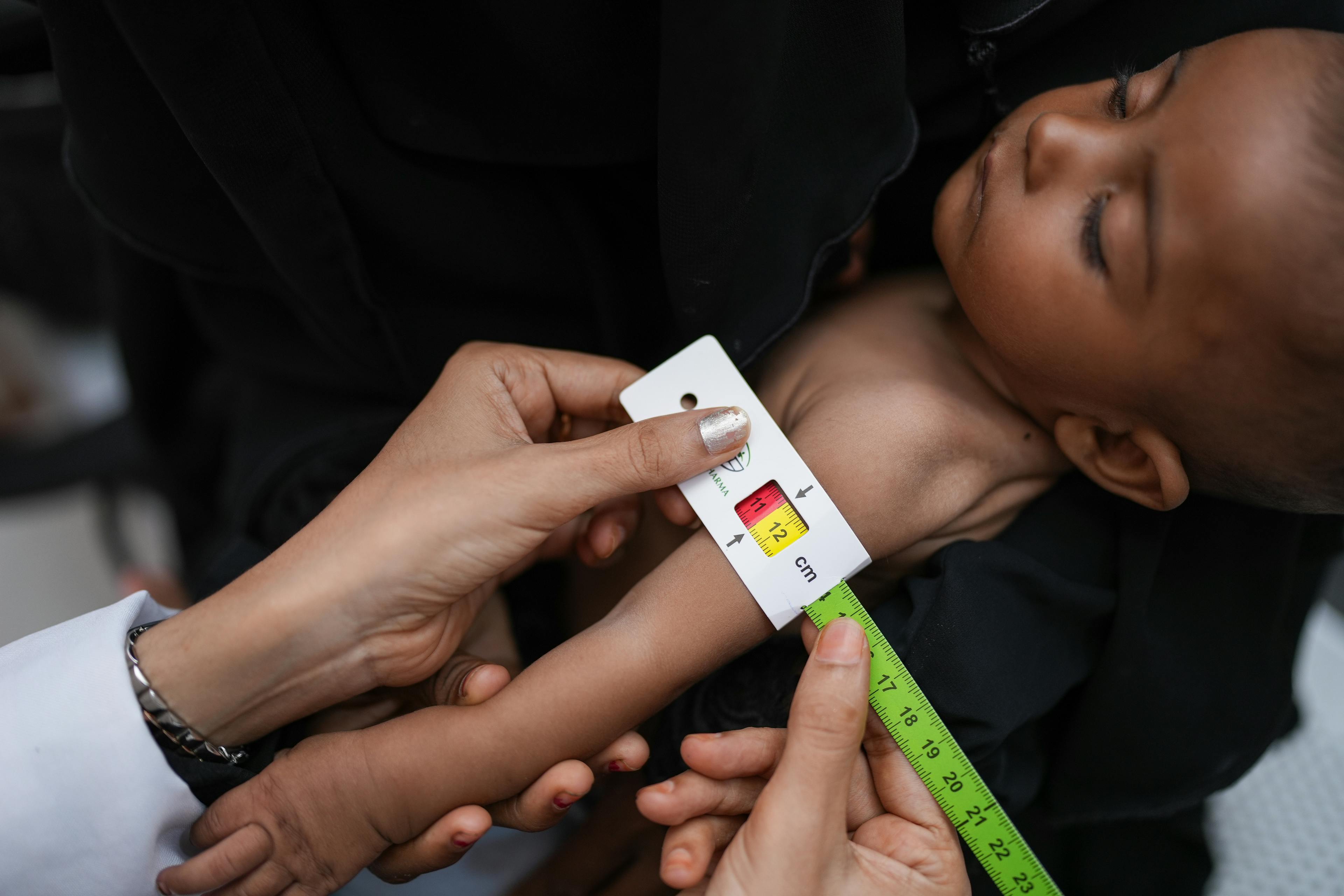 Baby Sanad is held by his 18-year-old mother, Raneem, as a health worker diagnoses his malnutrition by measuring his mid-upper arm circumference.