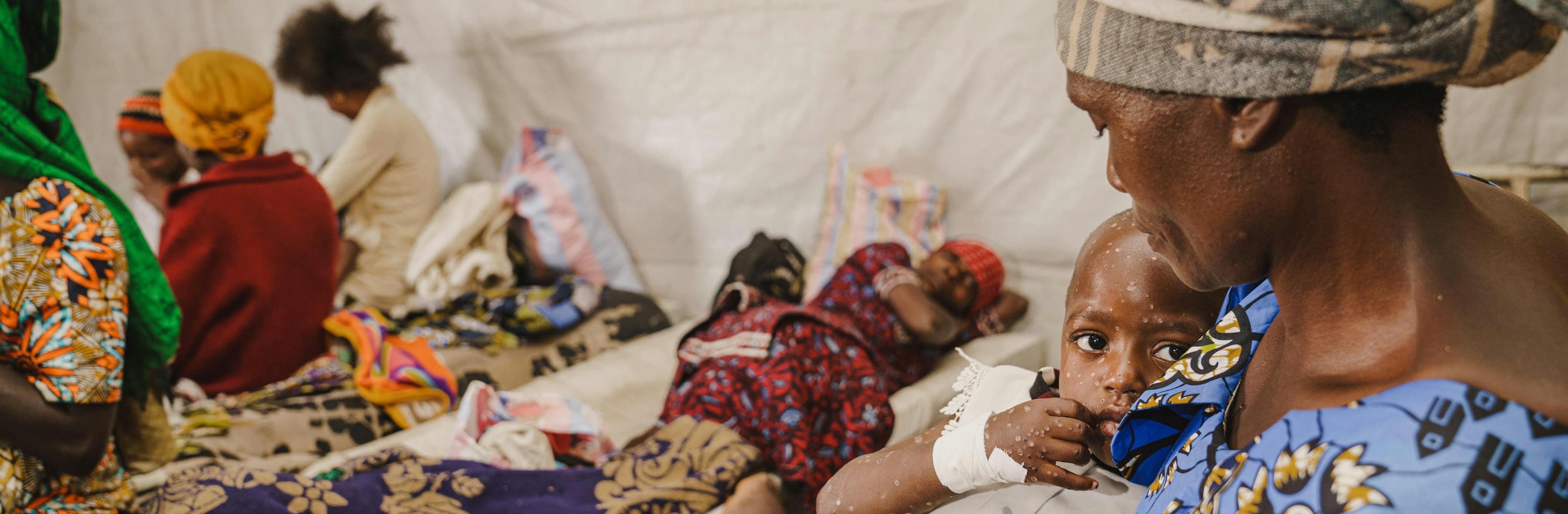 A mother holds her child suffering from mpox at the isolation unit of the UNICEF-supported Kavumu Hospital in South Kivu province, DR Congo