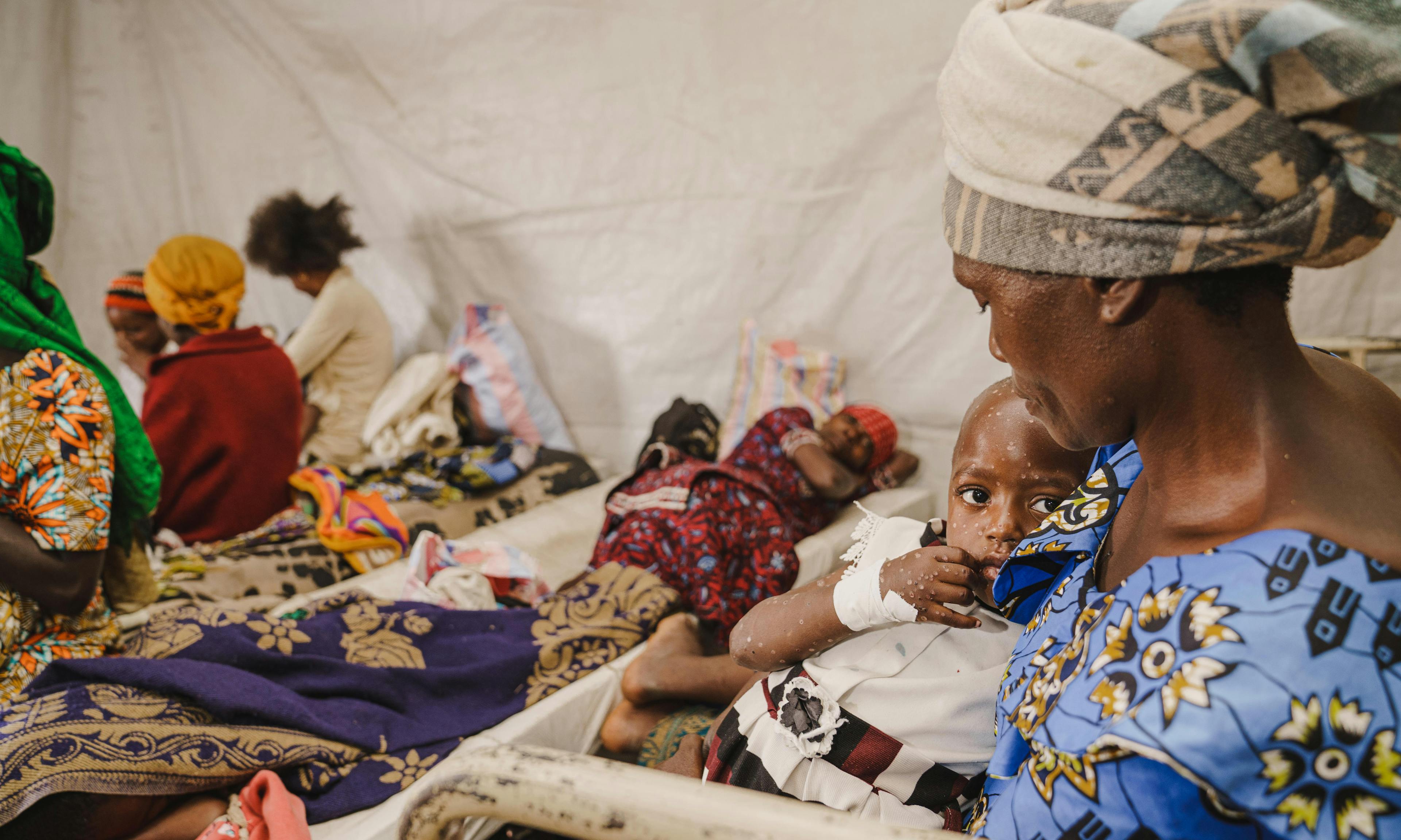 A mother holds her child suffering from mpox at the isolation unit of the UNICEF-supported Kavumu Hospital in South Kivu province, DR Congo