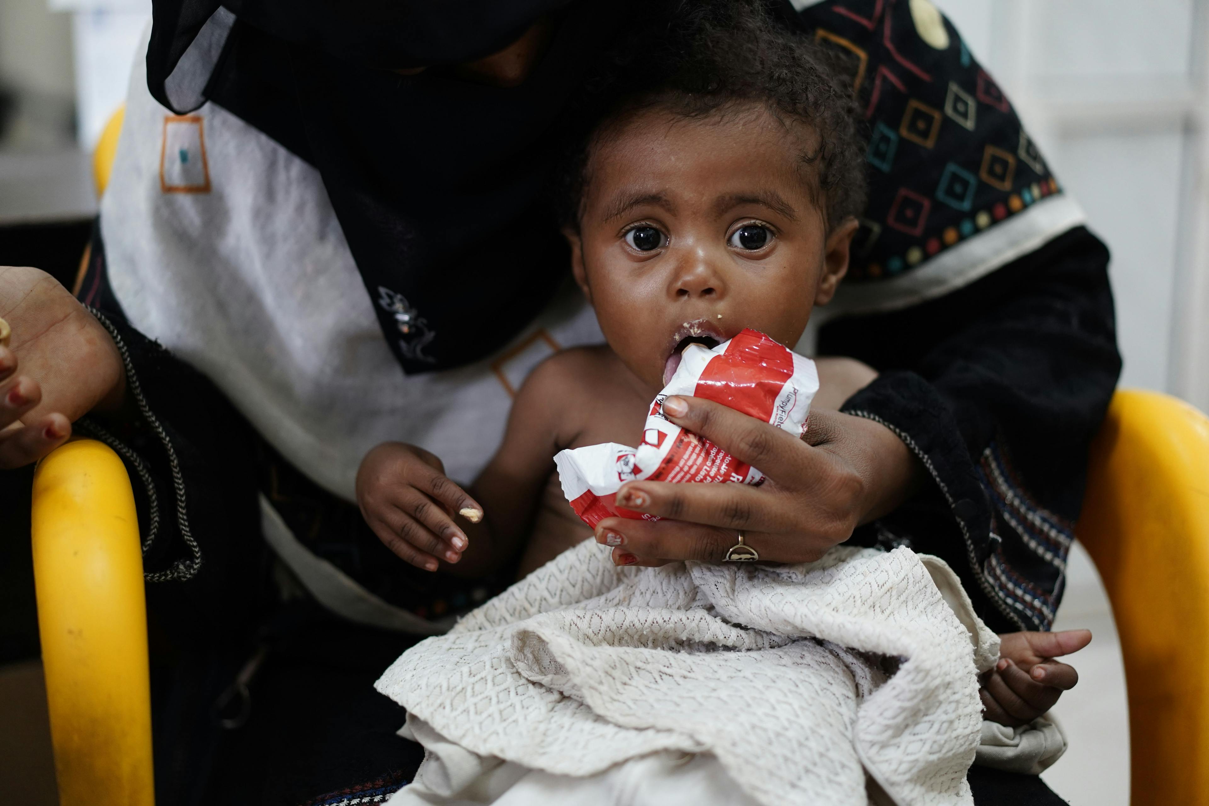 Jawaher (14 months), being fed therapeutic food to treat her malnutrition. 