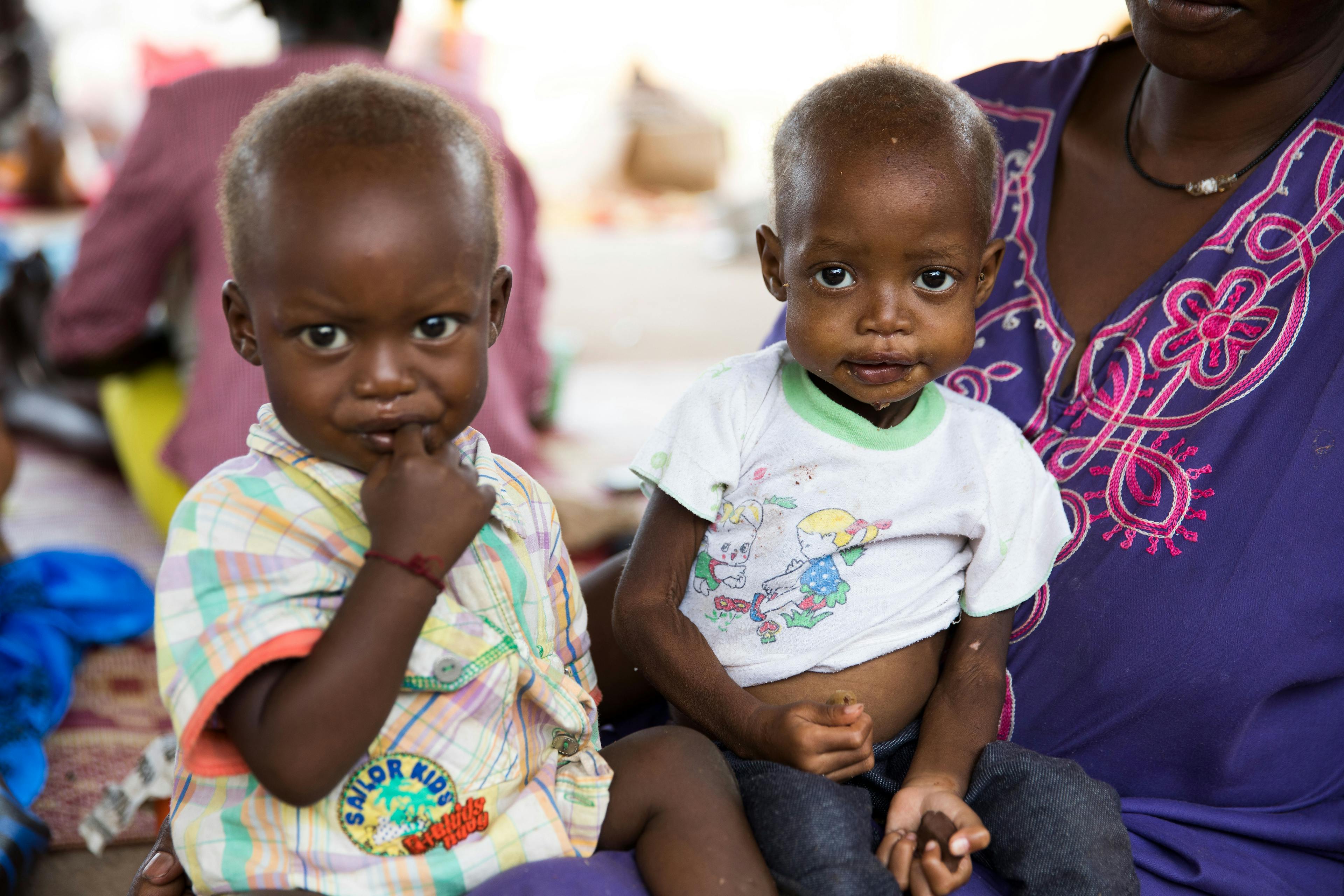 Juba, South Sudan, Julia Robert (37) with twins Wola (girl- malnourished, right) and Aladdin (boy), 15 months old at the ward for malnourished children of the Al Sabbah Childrens hospital in Juba, South Sudan. 