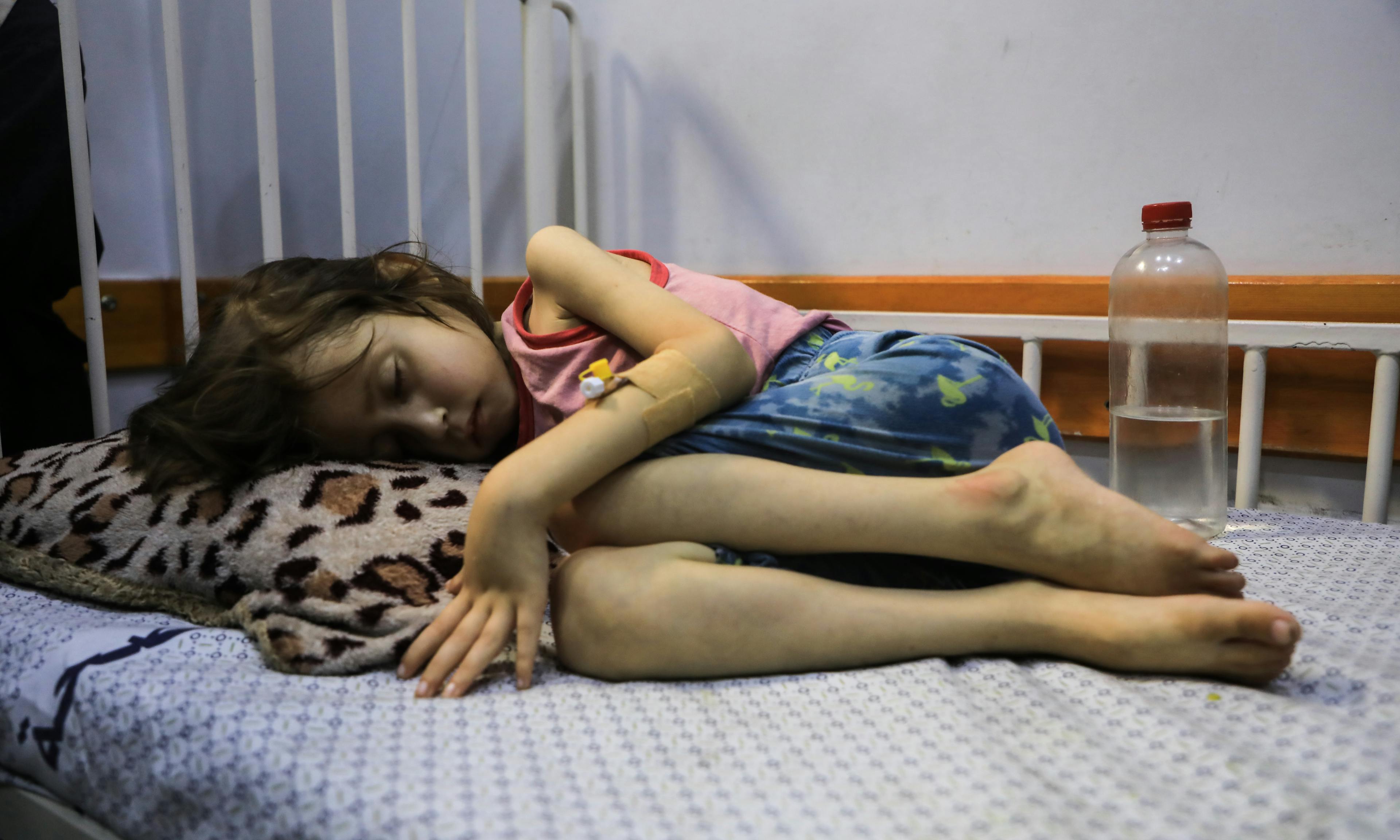 A child suffering from malnutrition lies on a bed in the Patient Society Hospital in Gaza City on 29 July 2025, during a visit by Ted Chaiban (not pictured), UNICEF Executive Director for Humanitarian Action and Supply Operations.
