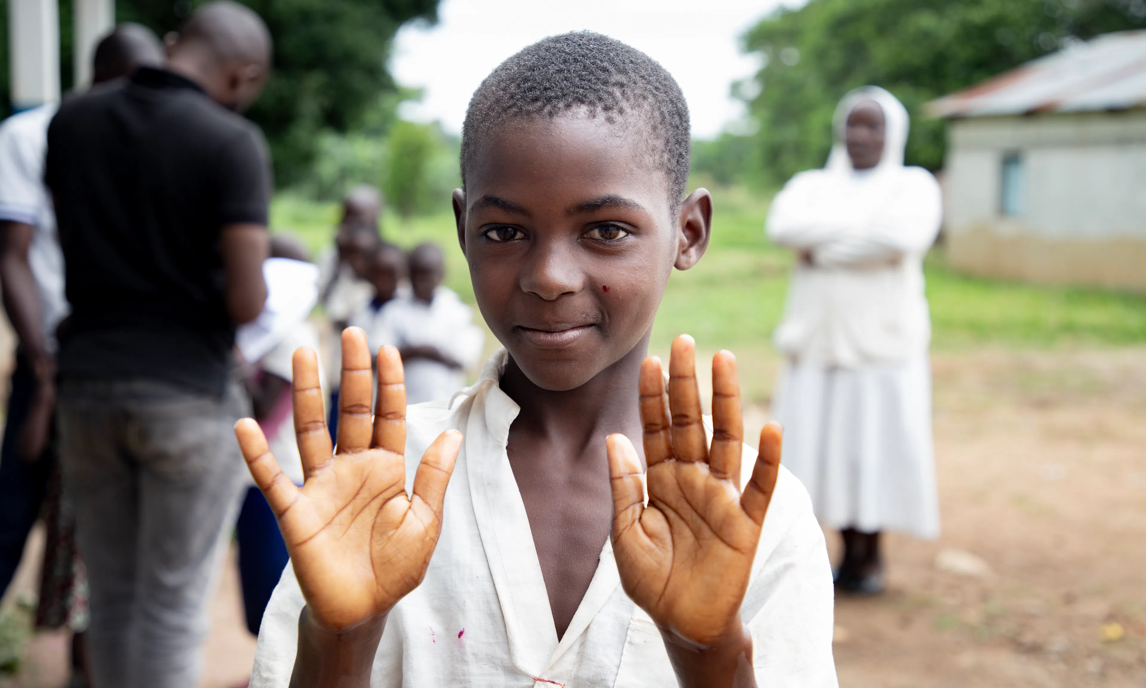 Omega, 11, shows his hands after washing them at Biringi Primary School in Ituri Province, DR Congo, on 16 May 2026.
