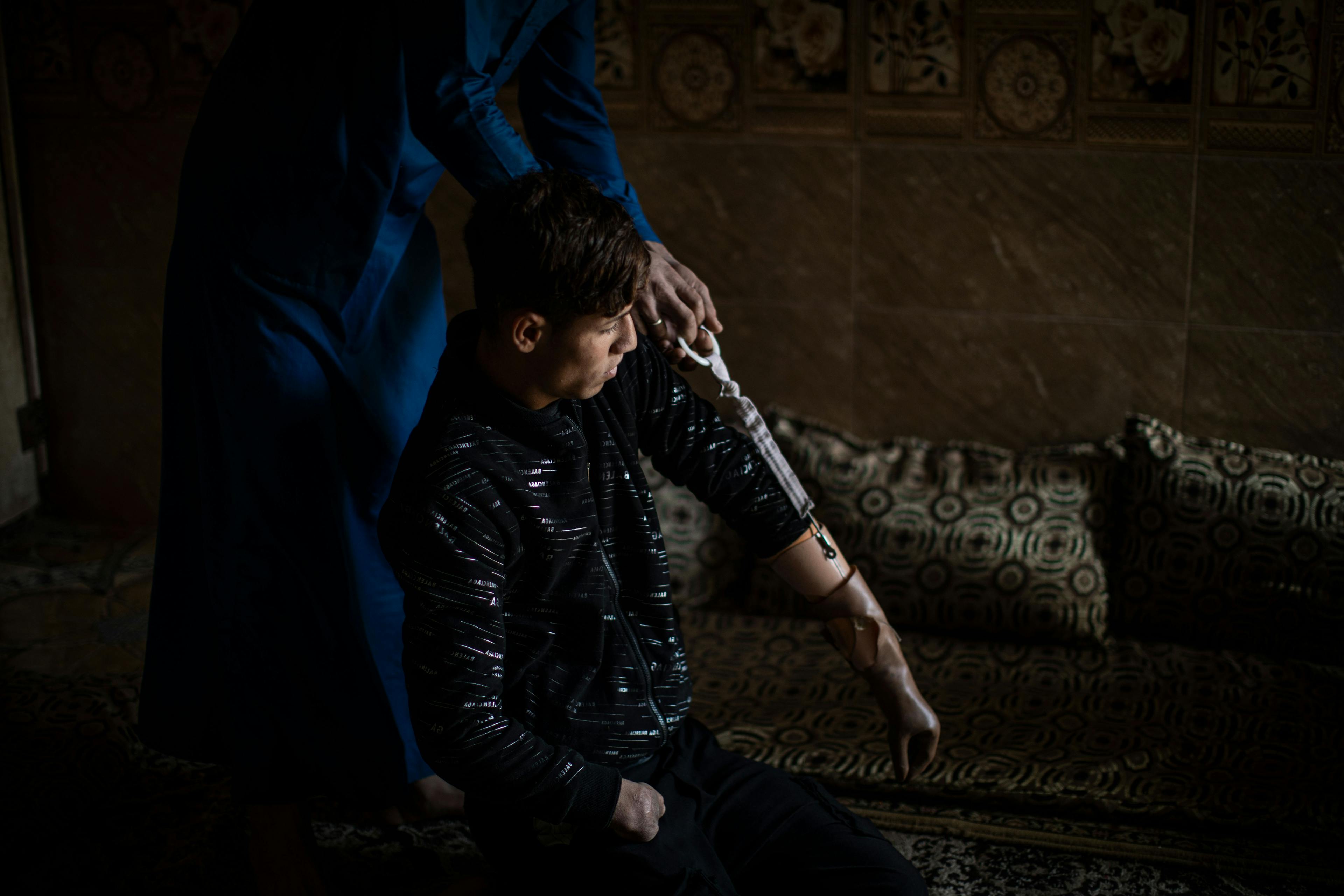 On 7 March 2022 in Iraq, 17-year-old Ali is helped in putting on a prosthetic hand by his brother, Sa'ad, at their home in Mesherfa, on the outskirts of Mosul. 