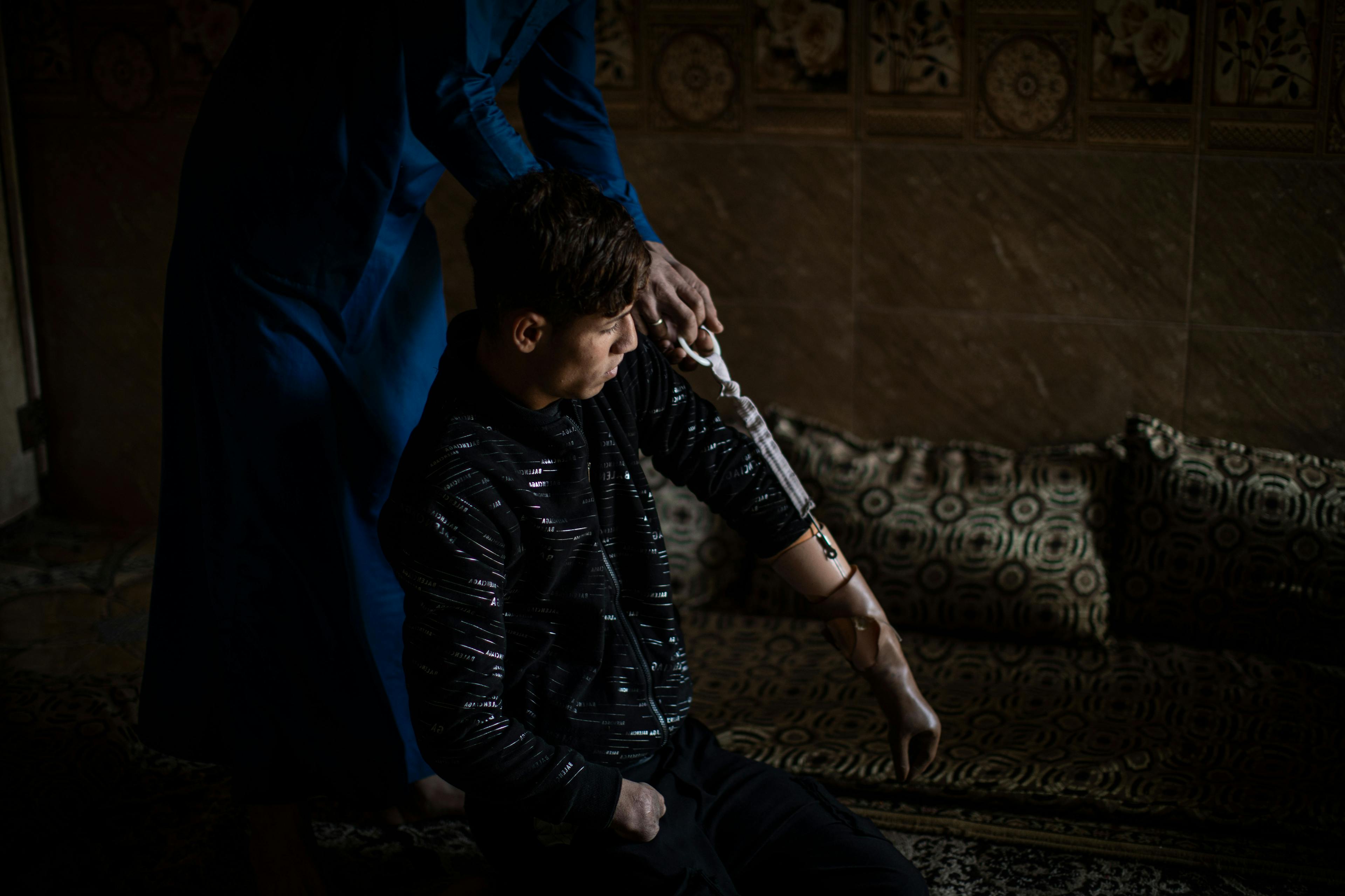 On 7 March 2022 in Iraq, 17-year-old Ali is helped in putting on a prosthetic hand by his brother, Sa'ad, at their home in Mesherfa, on the outskirts of Mosul.