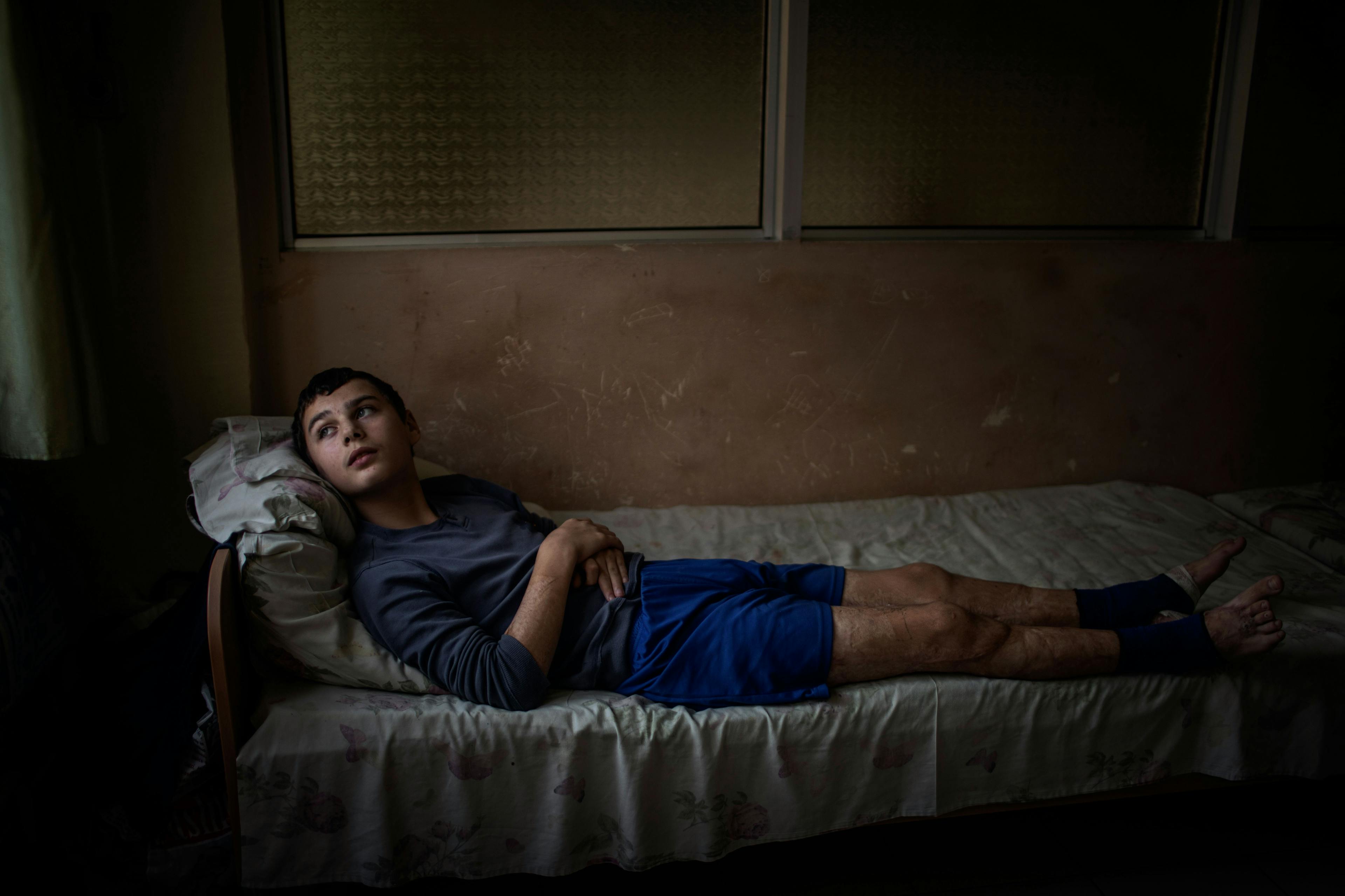 On 24 September 2022 in Lviv, Ukraine, 12-year-old Mykhailo Baev looks out a window while resting on a bed at Saint Nicholas Pediatric Hospital.