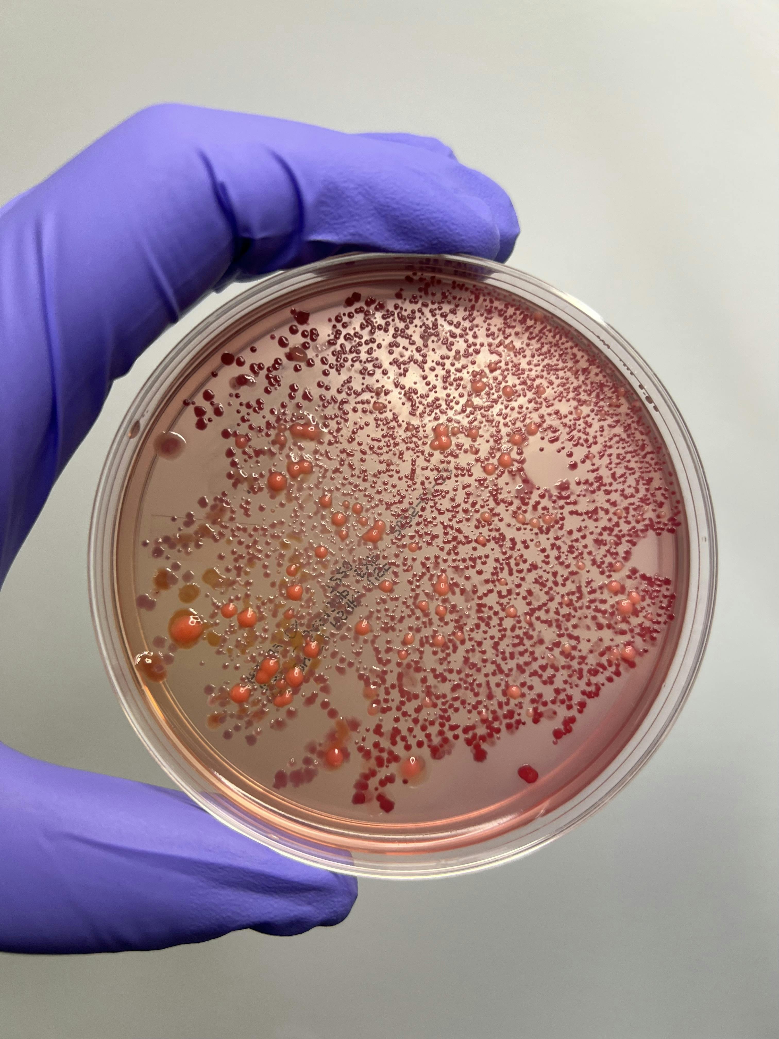 Bacteria Culture Plate