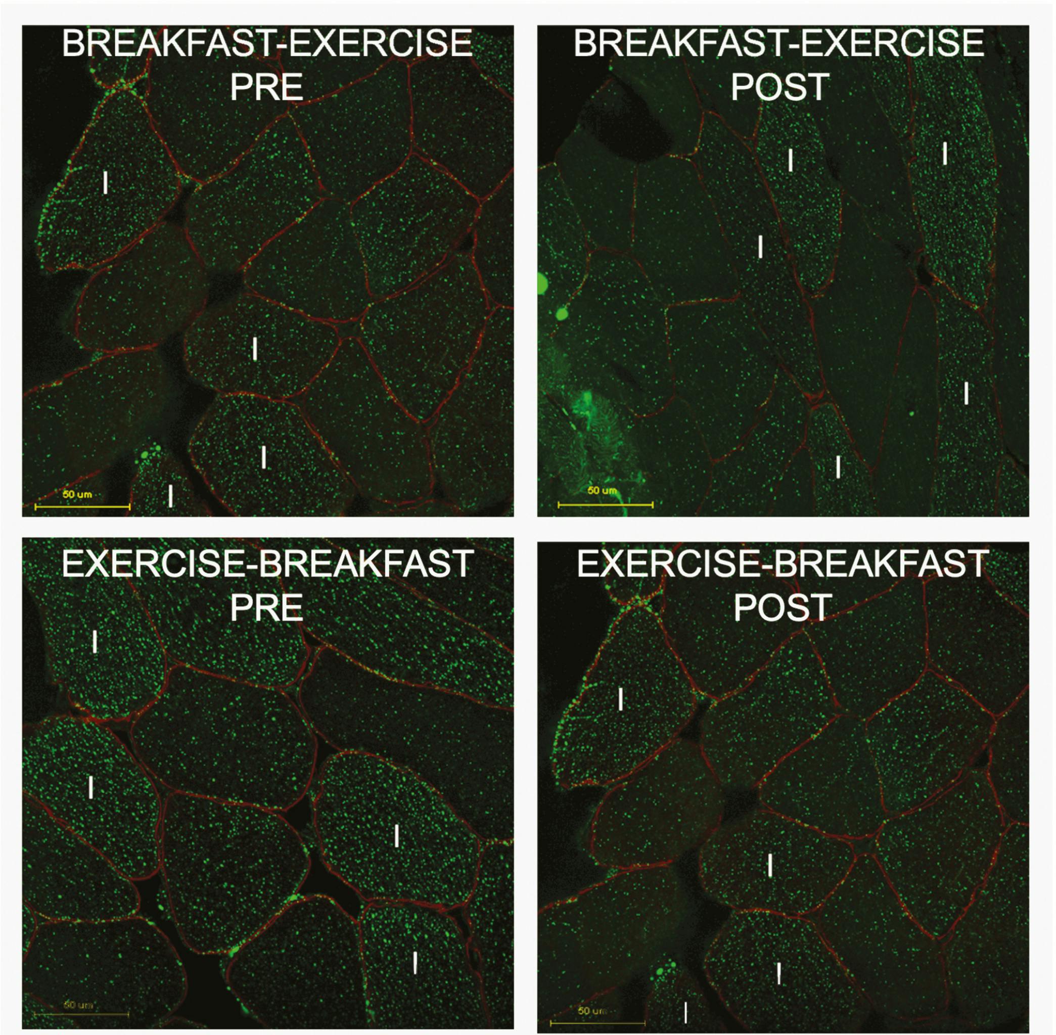 chart depicting exercise before and after breakfast