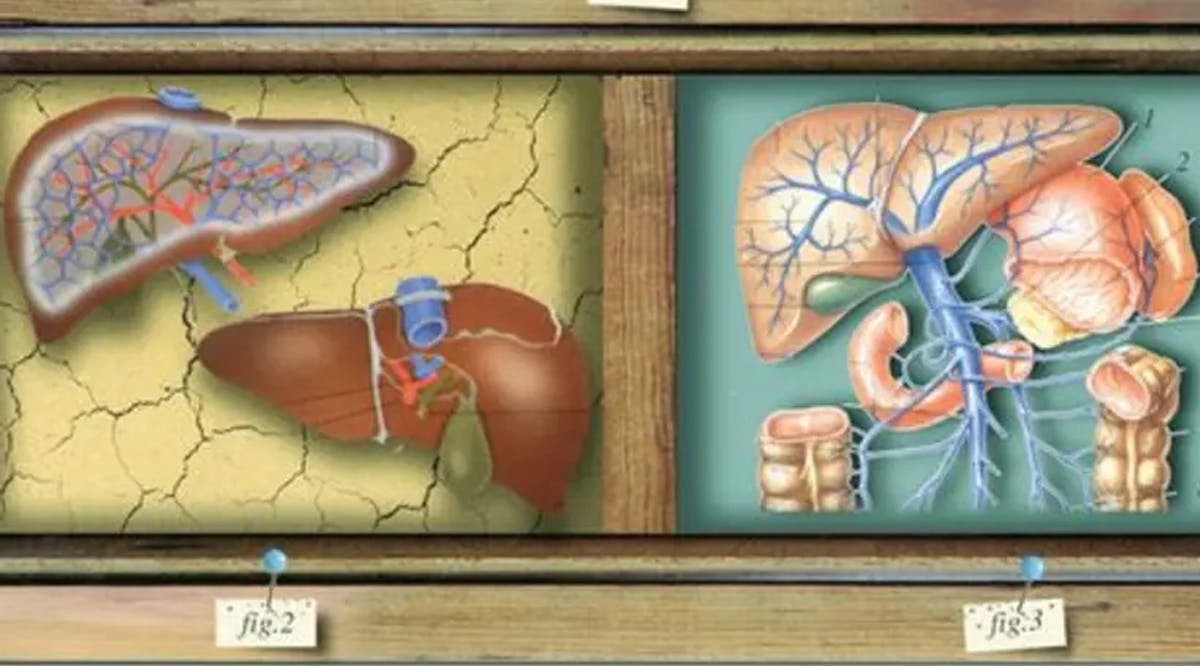 A model of human kidneys