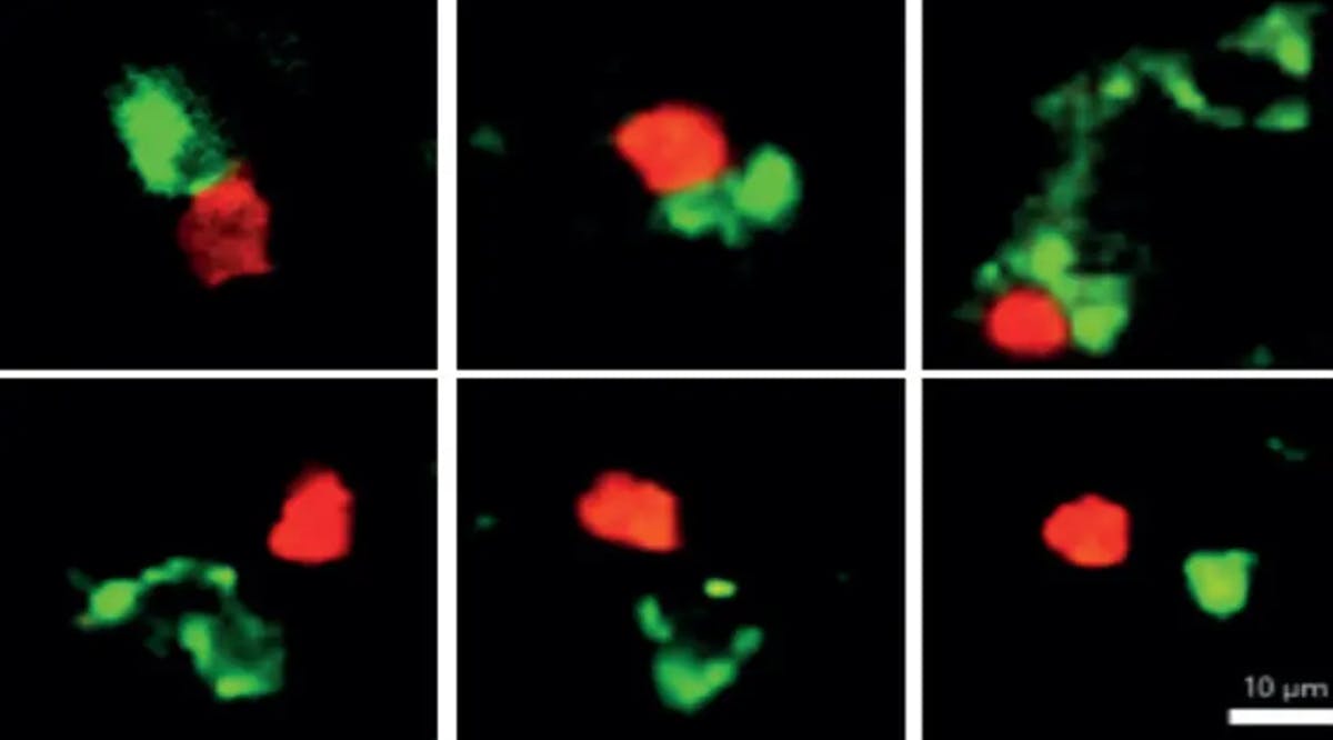 A Candida-fighting TH17 cell