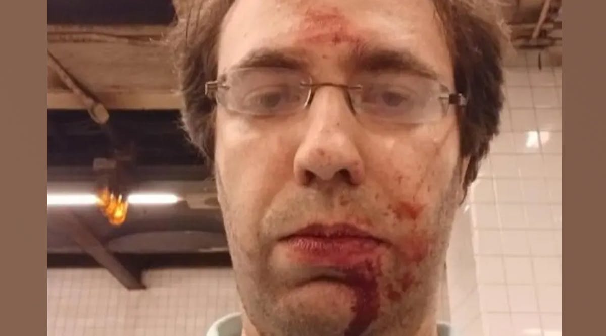 Fima Zlatsin following his assault on a New York City subway