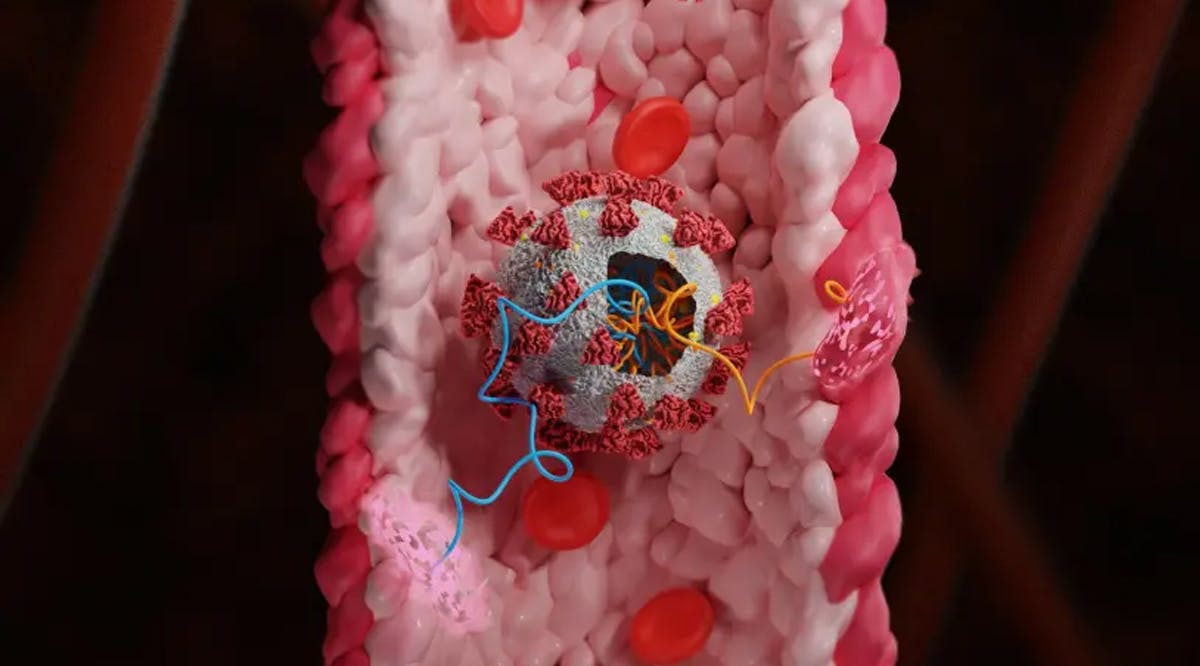 COVID-19 is seen in a blood vessel