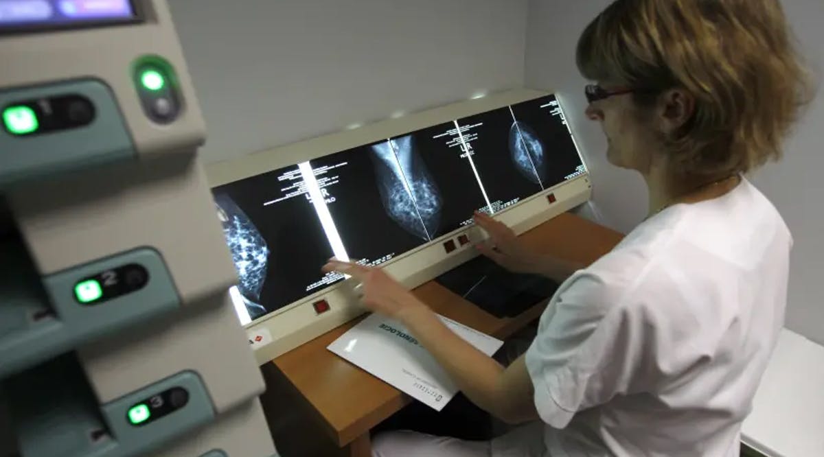 A radiologist examines X-rays