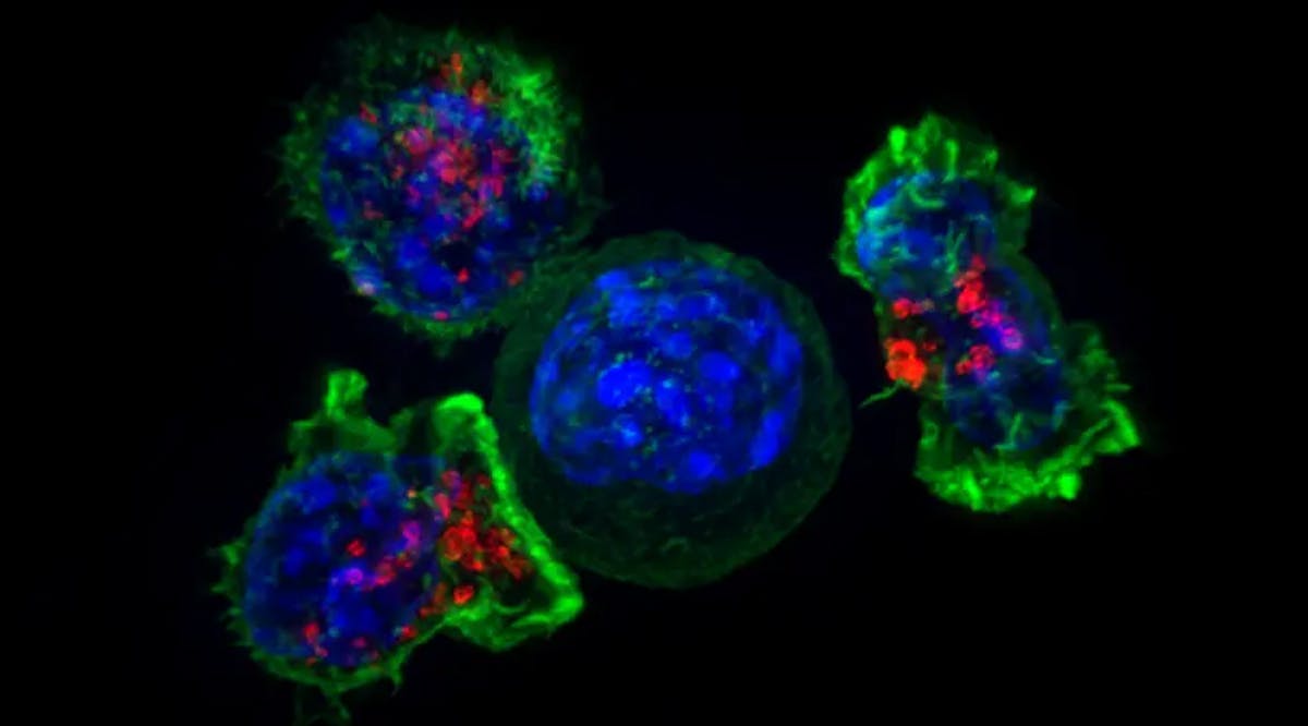 Superresolution image of a group of killer T cells (green and red) surrounding a cancer cell (blue, center)