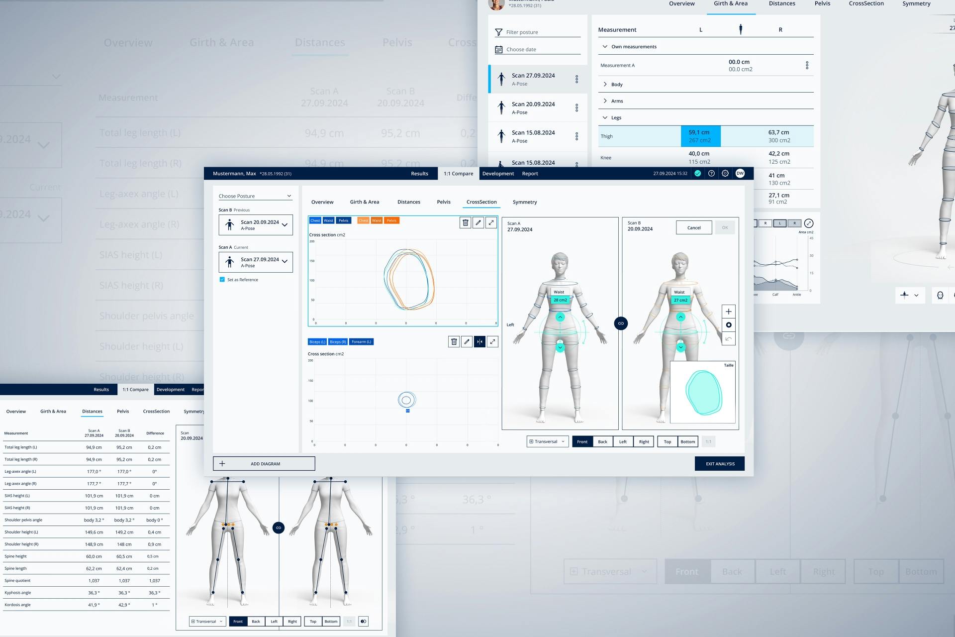 3D-Körperscans zum Body Tracking mit BodyLoop