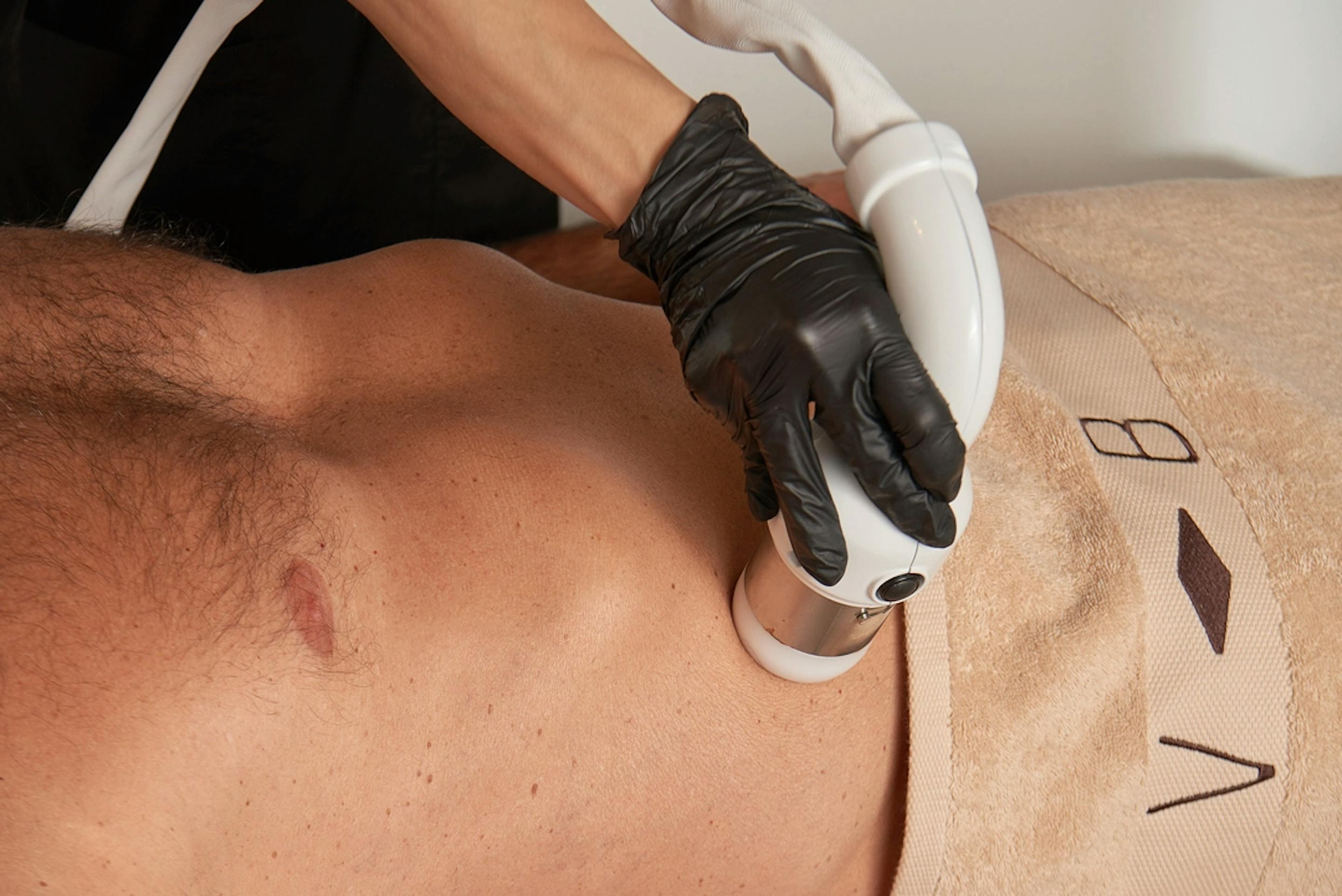 dettaglio tecnologia cfu ultrasuoni focalizzati