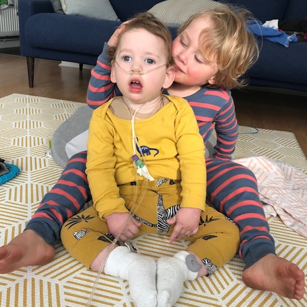 Two children sitting on the floor, one with an oxygen tube.
