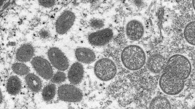 Imagem do vírus monkeypox feita em laboratório. Fonte: Reprodução/Secretaria de Saúde do RS