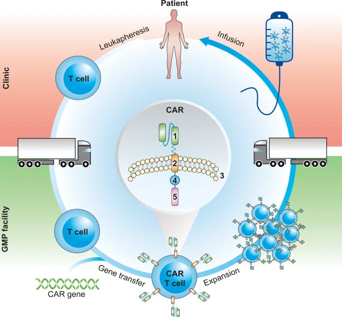 Manufacturing of and treatment with SB transposon-generated CAR-T cells