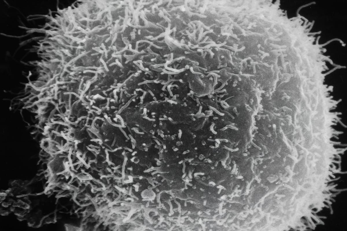 Single Cell RNA-Seq Graph