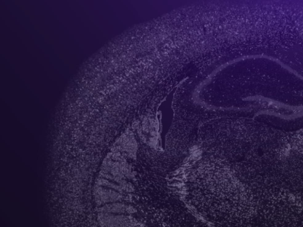 Feature Image Spatial Transcriptomics