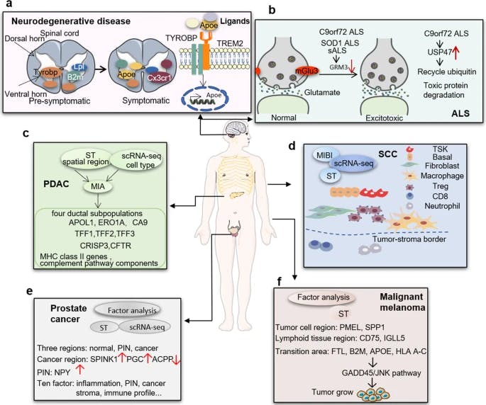 Examples of applications of spatial transcriptomics