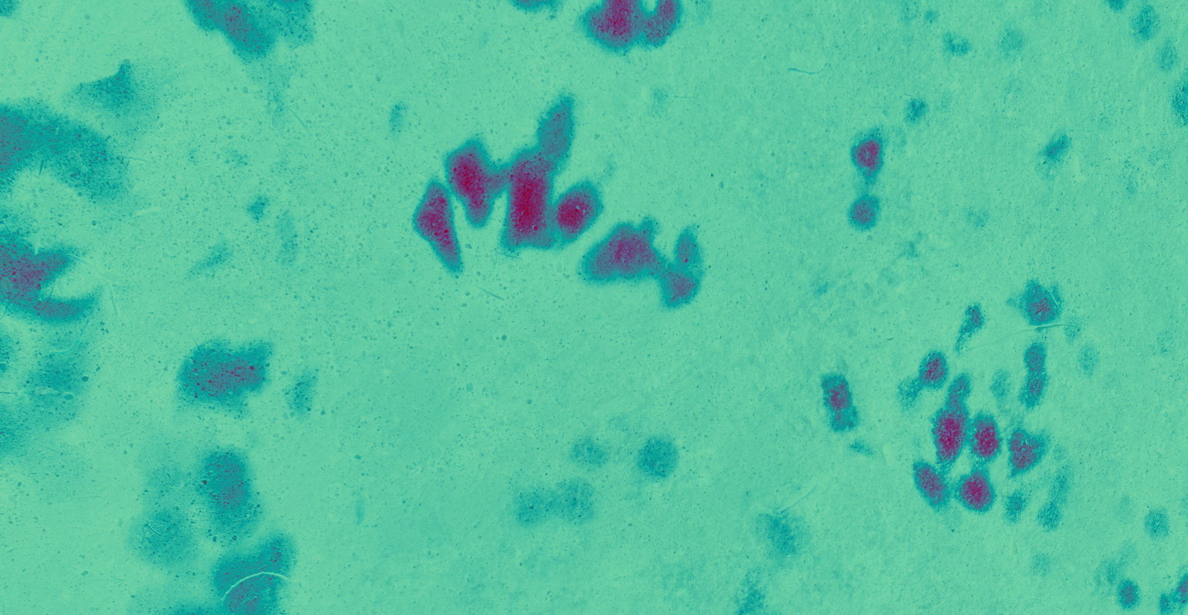 Blurred image of the sun shadows in the floor - Image for the submit section in Well/Coded website