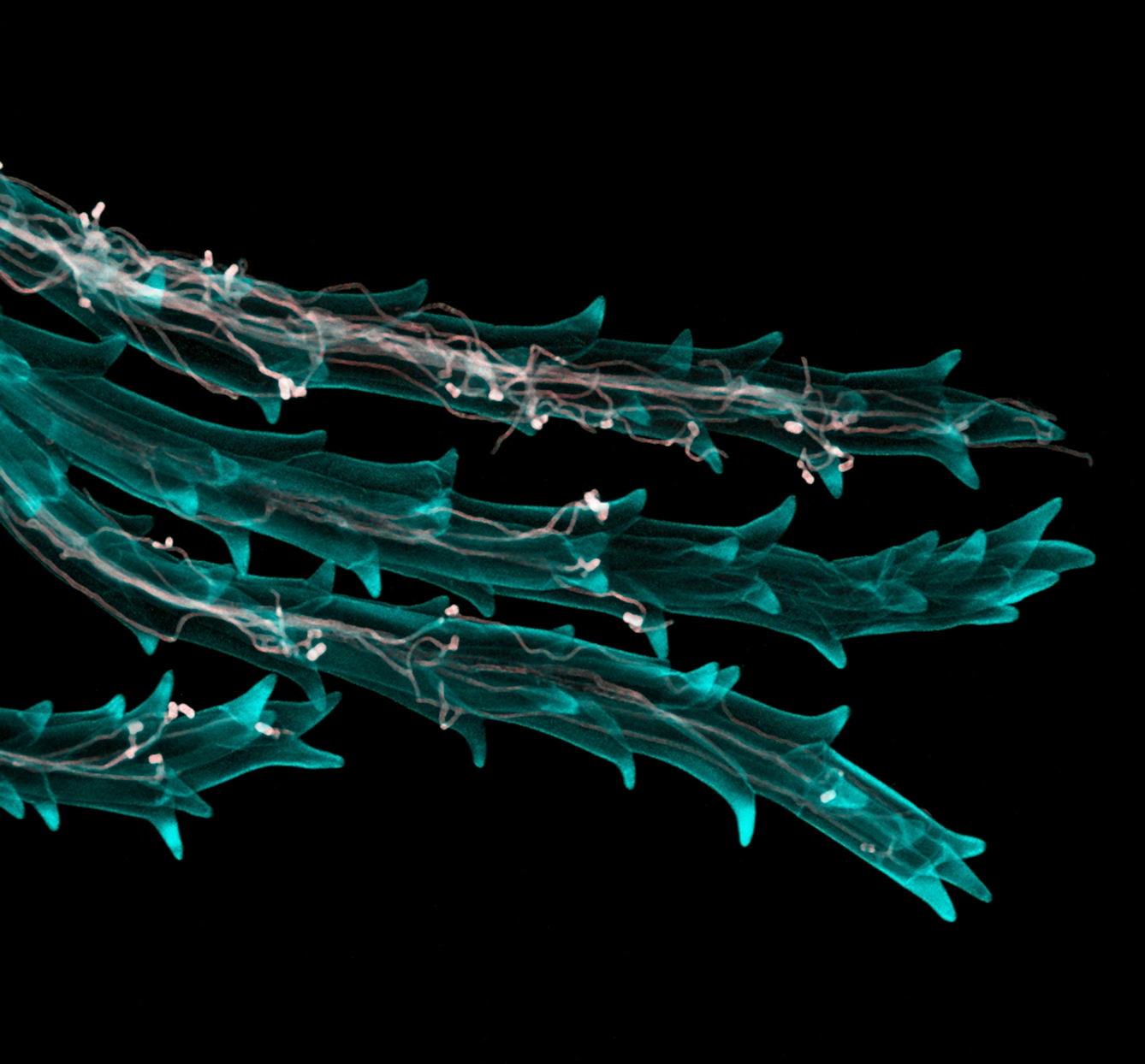 Microscope photograph of fungus on wheat, which appears as jagged reddish lines running down a greenish stem on a black background.