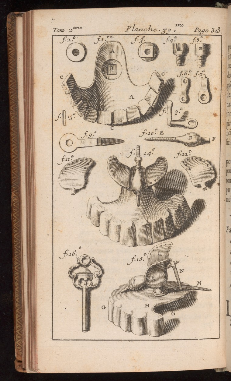 Illustration of dental tools and prosthesis.