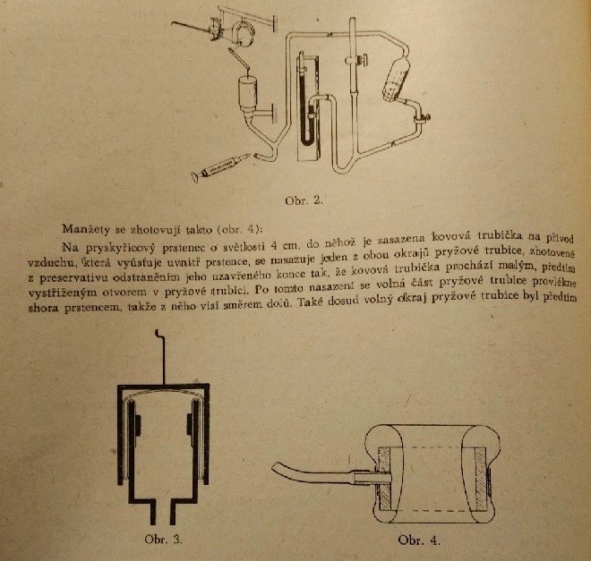 A journal page depicting the workings of a plethysmograph.
