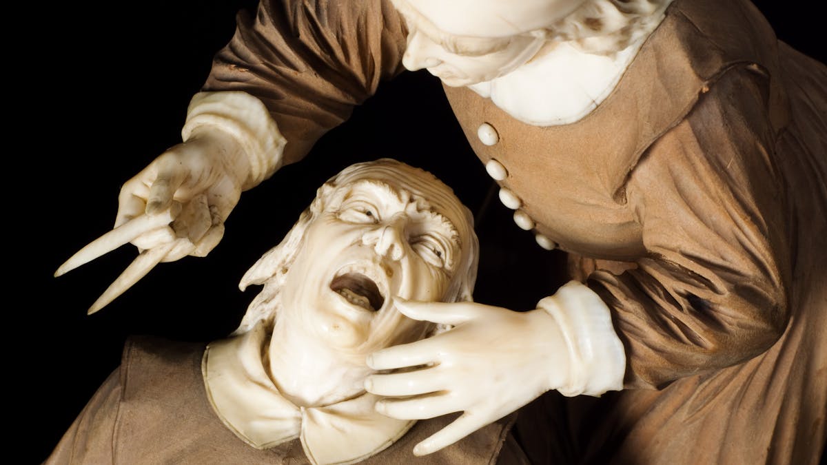 Close up photograph of a statue of a man being treated by a dentist. The patient is seated, with his head thrown back and his mouth open; the dentist is standing over him holding a dental instrument.