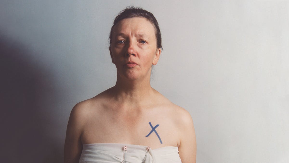Half-body self-portrait of Jo Spence, with her chest wrapped in white muslin secured with two nappy pins and a cross in blue marker pen on skin above her left breast.