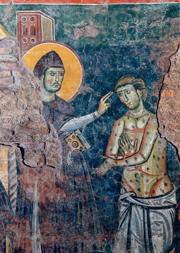 Detail from a mural showing a man with a halo gesturing towards a bare-chested man with leprosy.