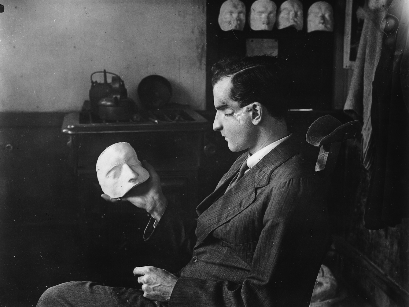 A patient examines a plaster cast of his own face which will be used to conceal the loss of his eye.