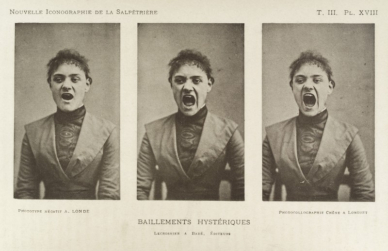 Series of three photos showing a so-called 'hysterical' yawning woman