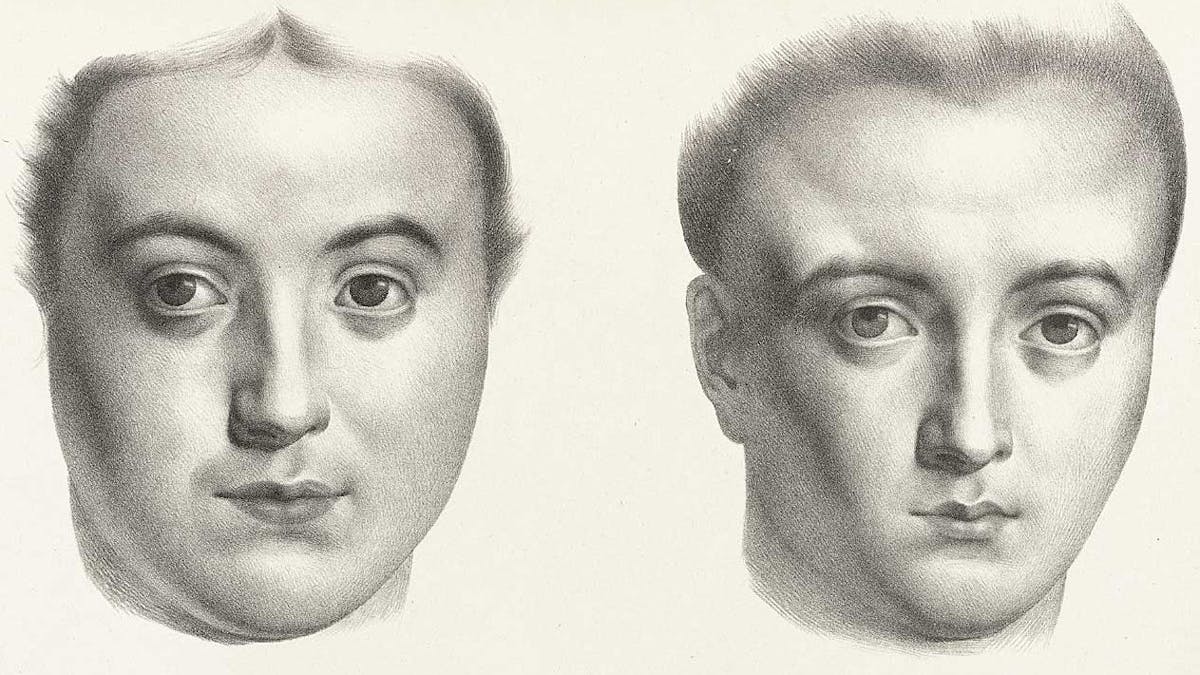 Black and white engraving of two women’s differently shaped heads.
