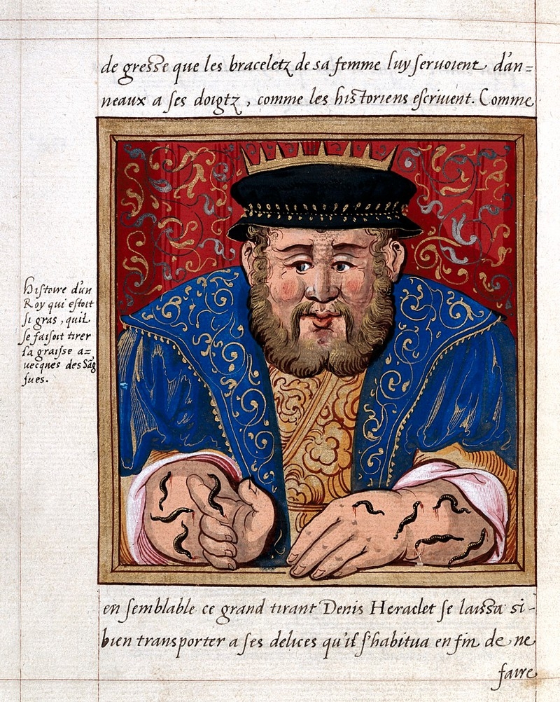 Illustrated manuscript showing a fat kind with leeches on his arms and hands