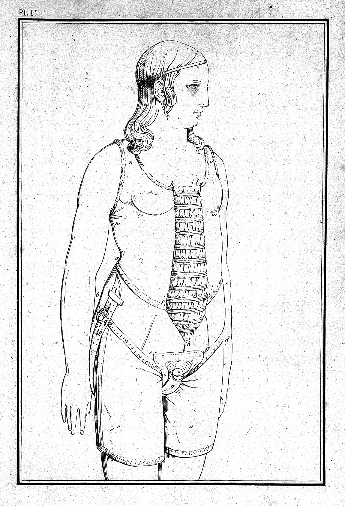 Woman wearing a corset for treatment against masturbation, 1822