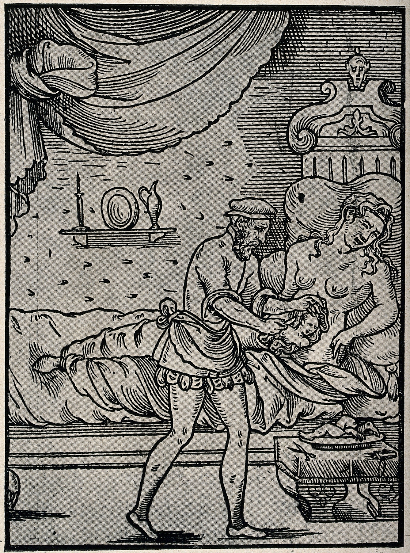 Reproduction of a woodcut illustration from 1560, showing a surgeon performing a Caesarean operation on an agonized woman who had apparently been carrying a dead baby in her womb for five years.