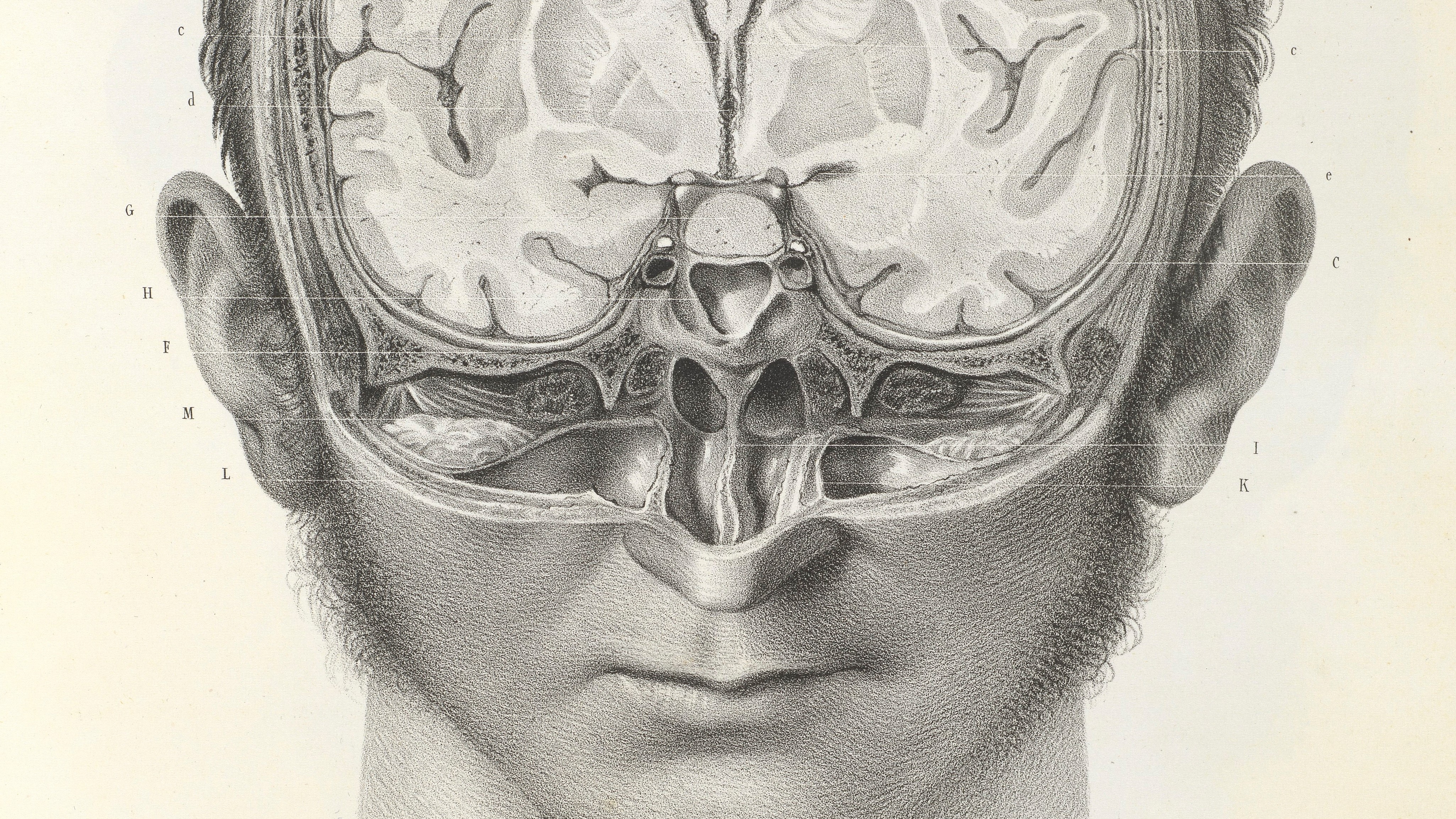 Black and white image showing a man’s head with part of it cut away to reveal the brain inside.