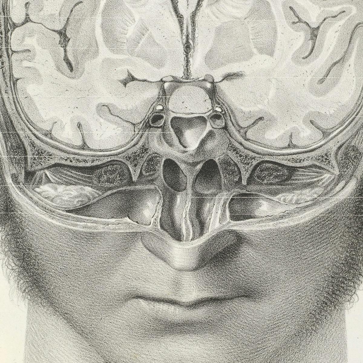 Black and white image showing a man’s head with part of it cut away to reveal the brain inside.