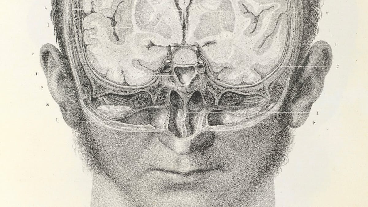 Black and white image showing a man’s head with part of it cut away to reveal the brain inside.